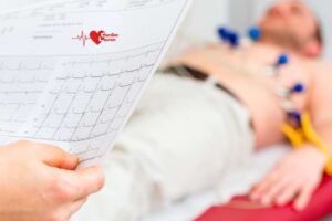What to expect after having a mild heart attack 3 What to expect after having a mild heart attack