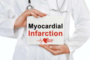 Myocardial infarction - heart attack - mild heart attack